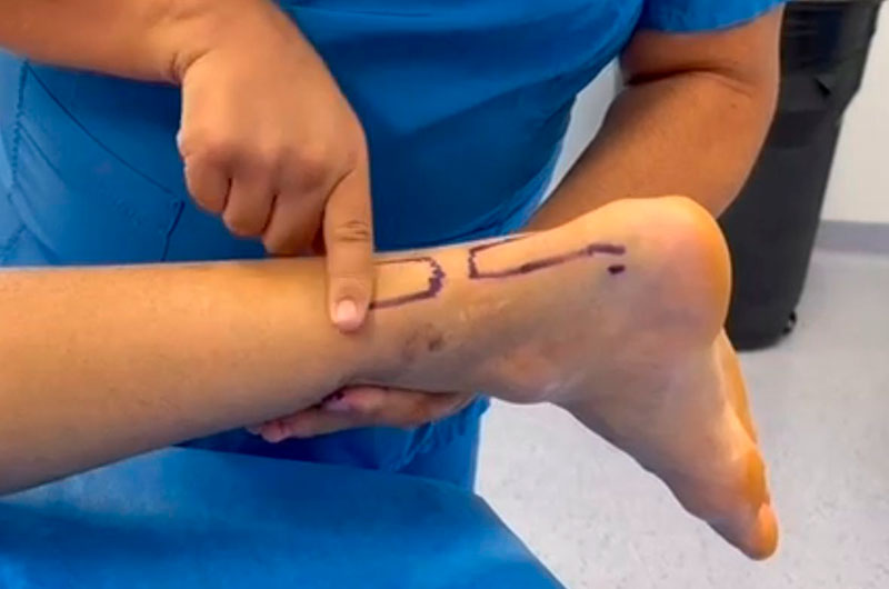 Antonio Ferrera inicia su programa de rehabilitación en Querétaro