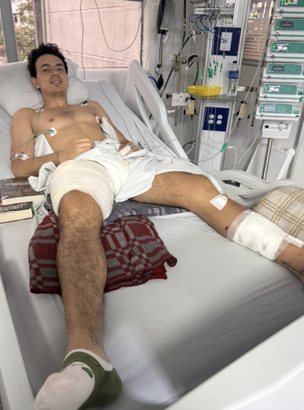 Juan de Castilla operado de nuevo de la extensa cornada que le atravesó el muslo