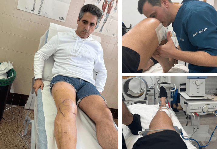 Emilio Serna acelera su recuperación tras la grave lesión sufrida en Acho